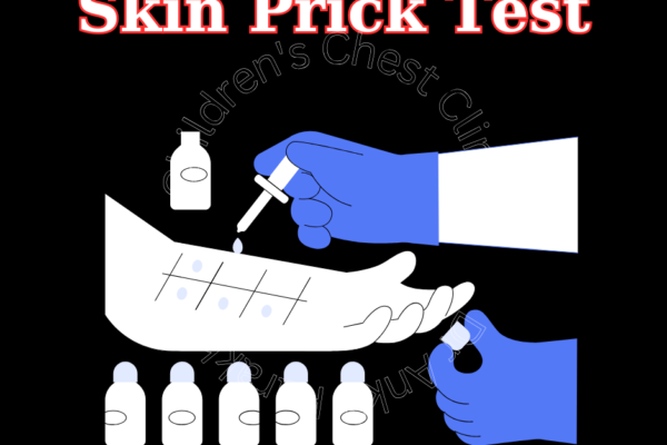 Understanding Skin Prick Tests