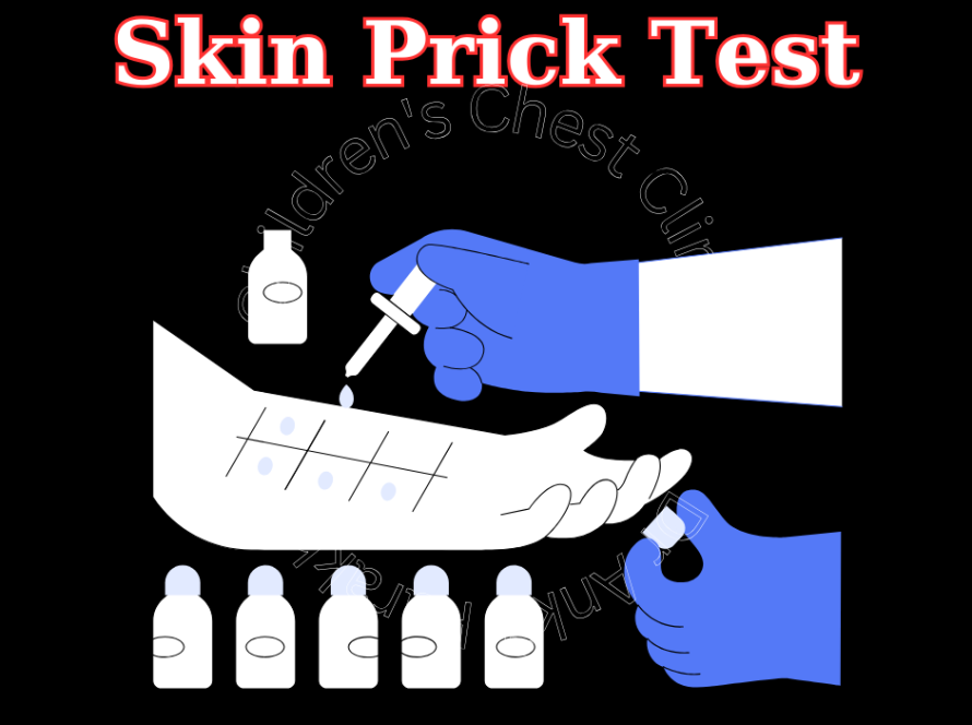 Understanding Skin Prick Tests