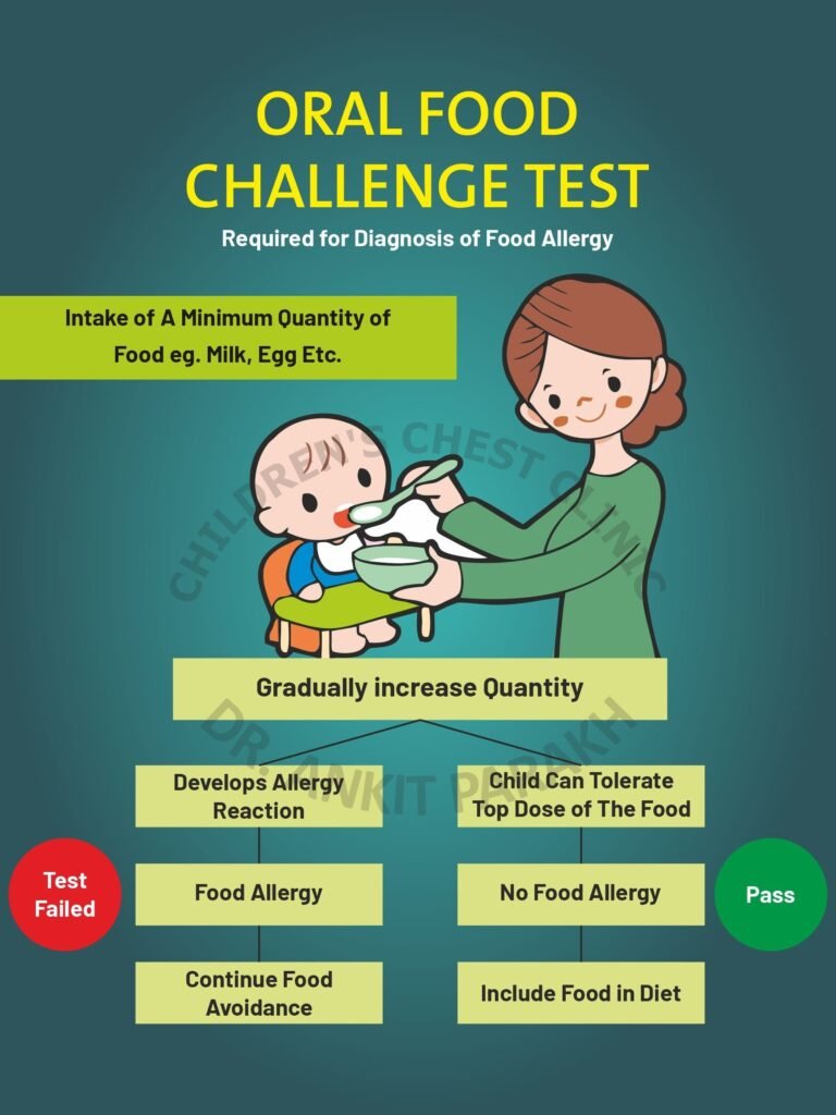 Oral Food Challenge