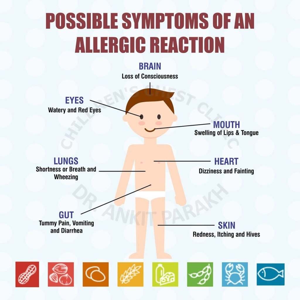 POSSIBLE SYMPTOMS OF AN ALLERGIC REACTION Web 768x768