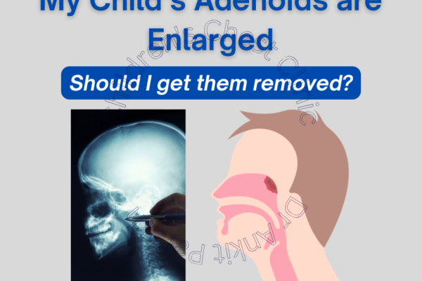 When do we need to get Adenoids removed in children?