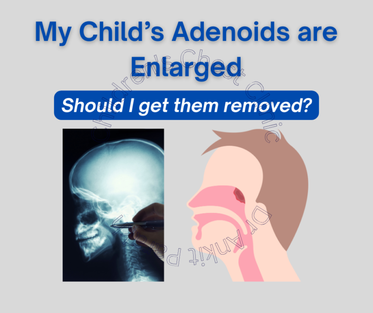 When do we need to get Adenoids removed in children?