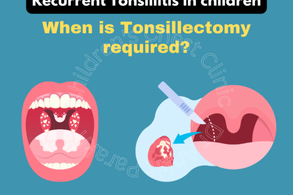 When is tonsillectomy required in children?