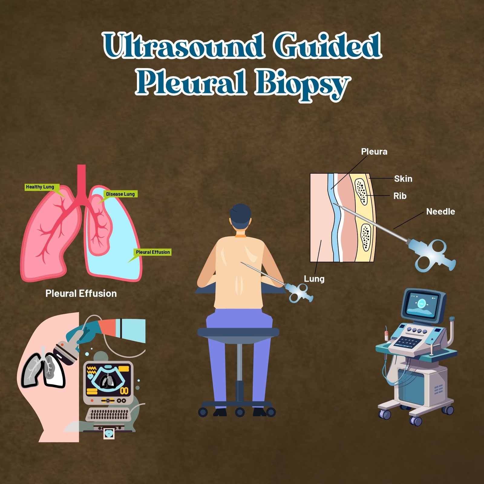 Ultrasound Guided Pleural Biopsy