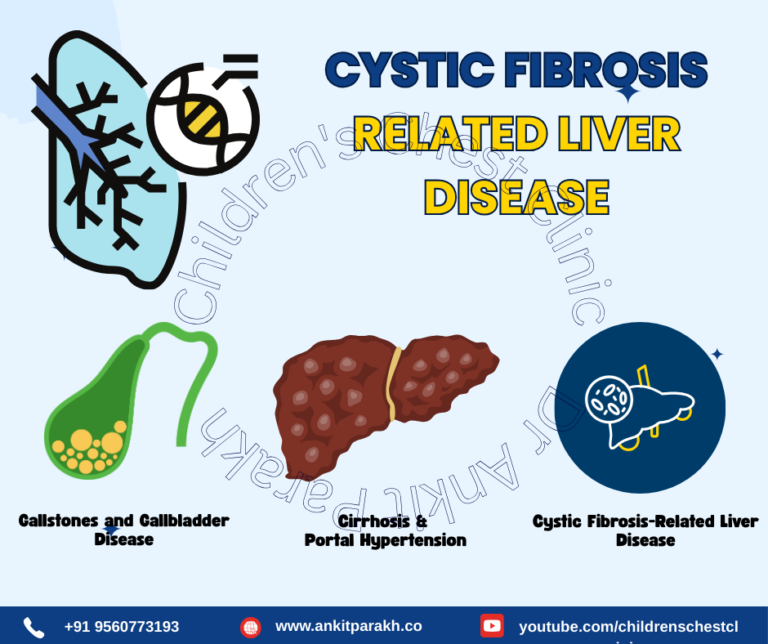Cystic Fibrosis-Related Liver Disease: Causes, Symptoms, and Management