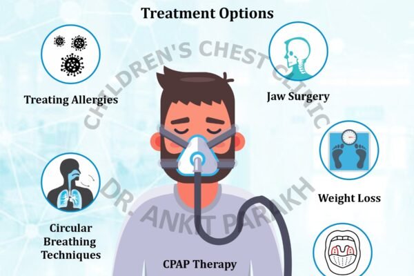 Treatment of Obstructive Sleep Apnea (OSA) in Children