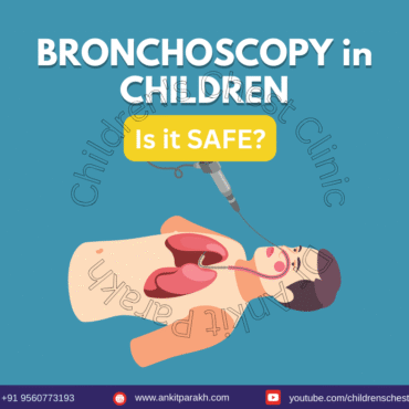 Flexible Bronchoscopy