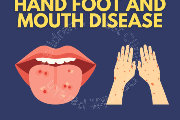 Hand Foot and Mouth Disease in Children