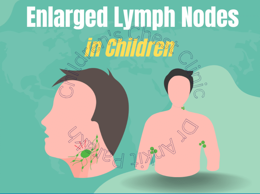 Enlarged Lymph Nodes in Children