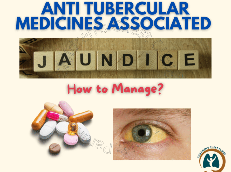 Antitubercular Drugs
