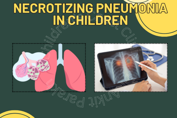 Necrotizing Pneumonia in Children