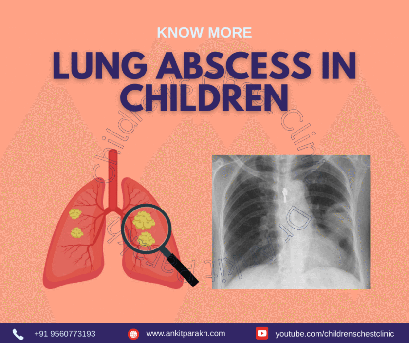 Lung Abscess in Children