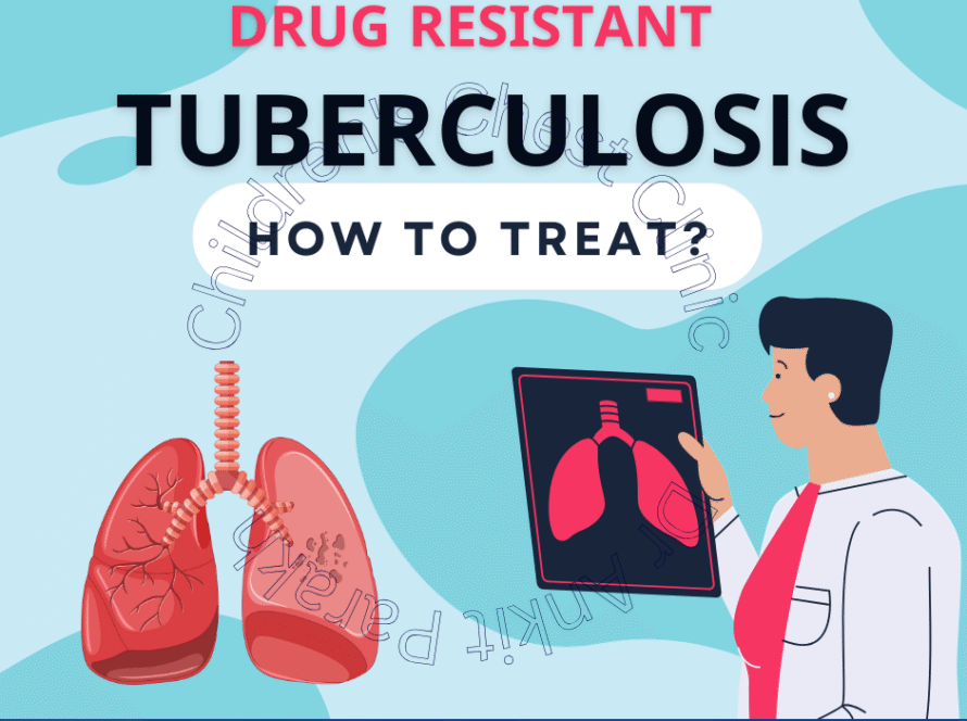 Treat MDR TB in Children