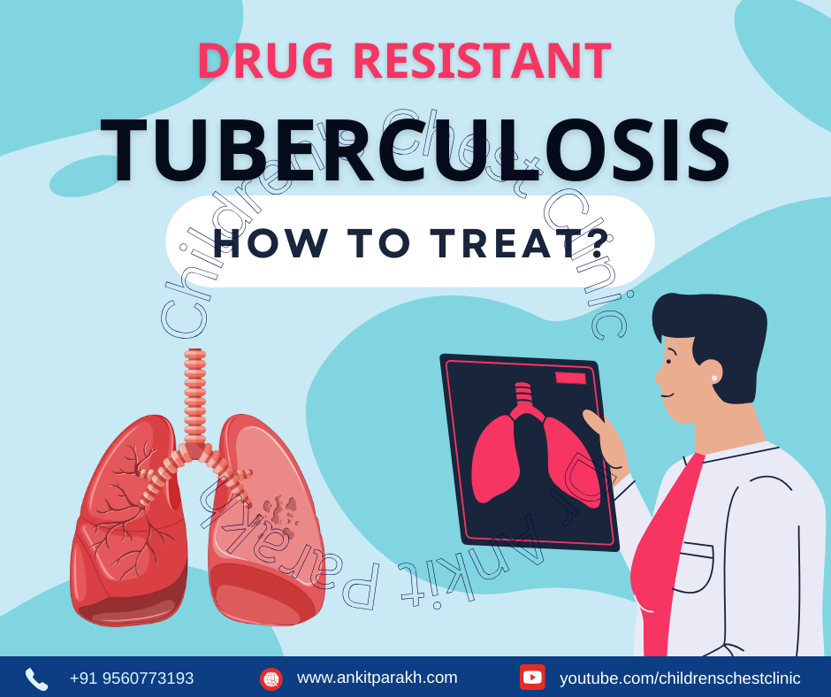 Treat MDR TB in Children