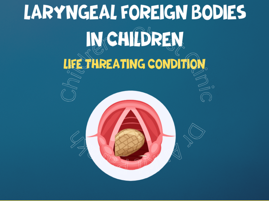 Laryngeal Foreign Bodies