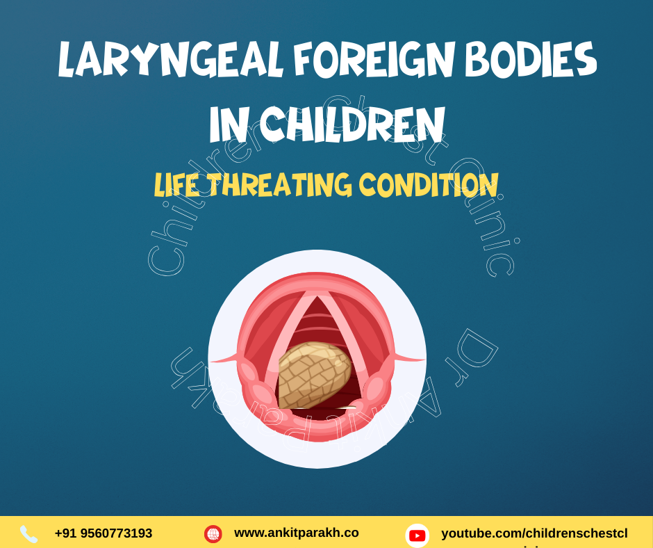 Laryngeal Foreign Bodies