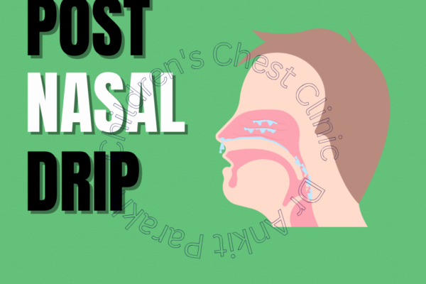 Postnasal Discharge