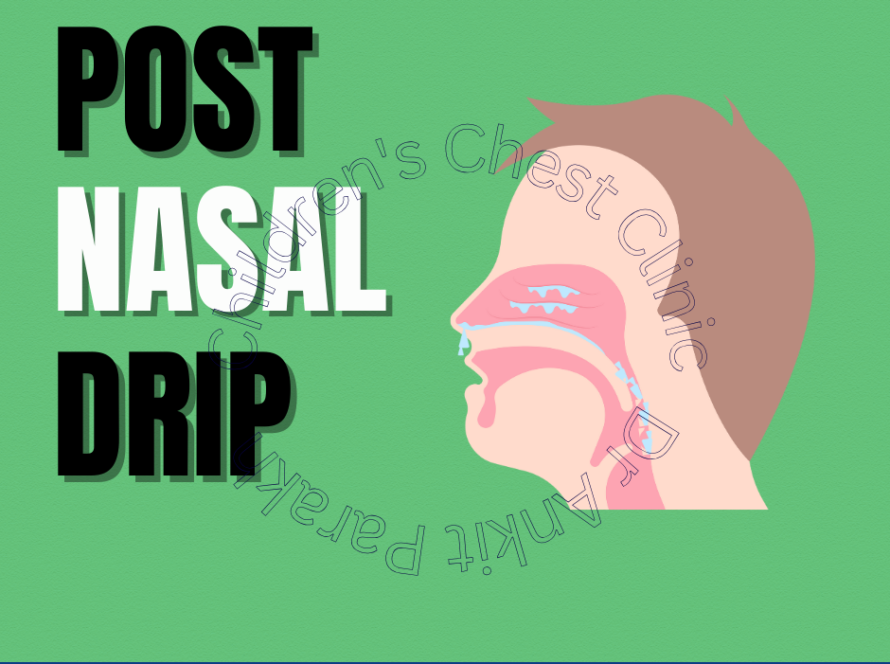 Postnasal Discharge