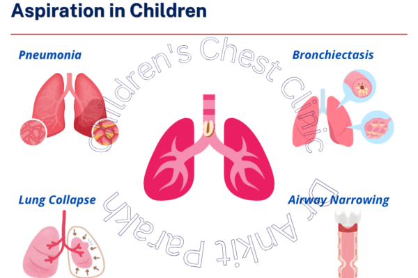 Long Term Complications of Foreign Body Aspiration in Children