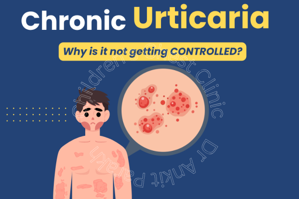 Foods commonly suspected in chronic urticaria in children