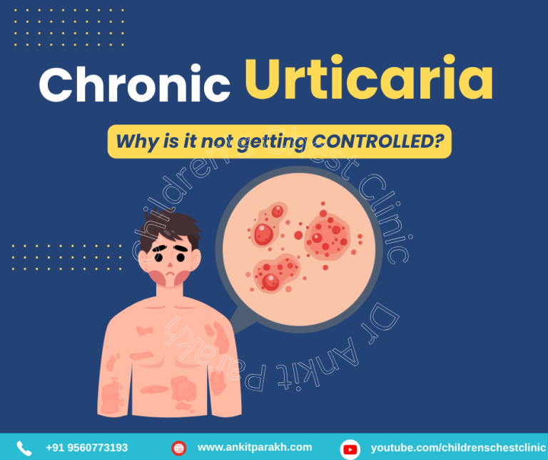 My Child’s Urticaria Is Not Getting Controlled: Causes and Treatment Options