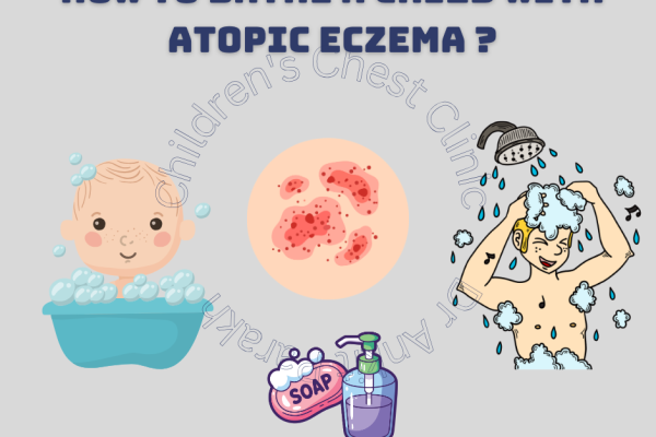 How to Bathe a Child with Atopic Dermatitis or Eczema: A Parent's Guide
