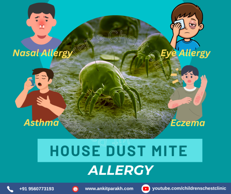 House Dust Mite Allergy in Children: Symptoms, Diagnosis and Treatment