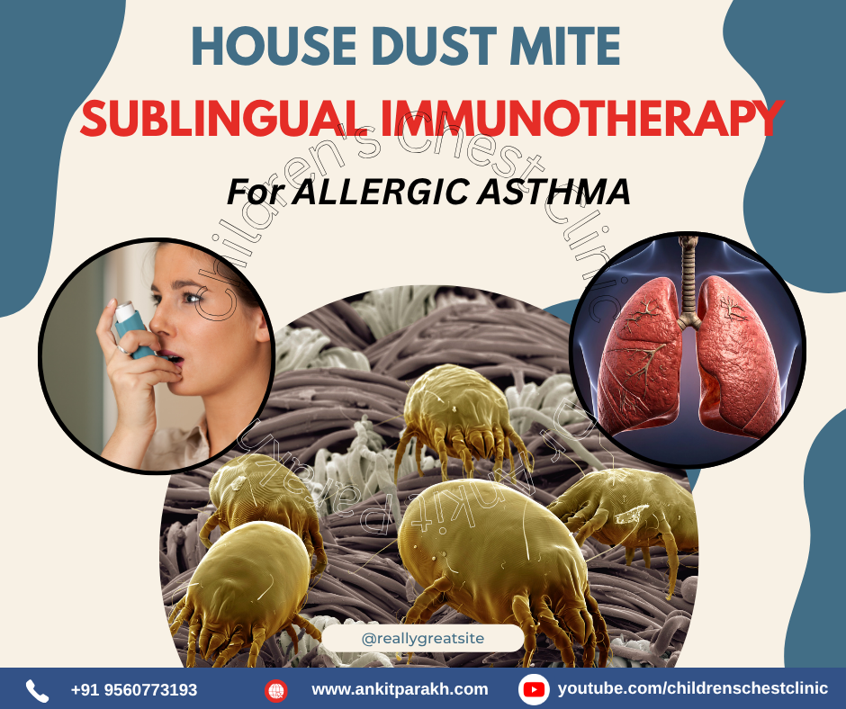 House dust mite sublingual immunotherapy for allergic asthma in children